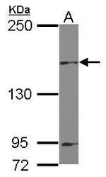 MINK1 Polyclonal Antibody