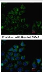 PANK3 Polyclonal Antibody