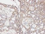 GLYCTK Antibody in Immunohistochemistry (Paraffin) (IHC (P))