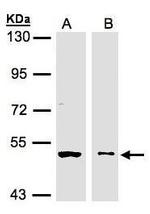 GLYCTK Antibody in Western Blot (WB)