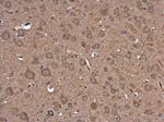 PIK3R5 Polyclonal Antibody