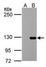 TIE1 Antibody in Western Blot (WB)