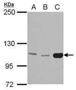 HK3 Antibody in Western Blot (WB)
