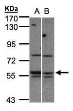 MST3 Polyclonal Antibody