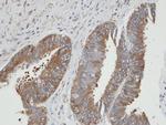PGK2 Polyclonal Antibody