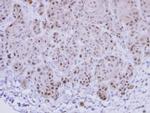 EXOSC10 Polyclonal Antibody