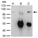 EXOSC10 Antibody in Immunoprecipitation (IP)