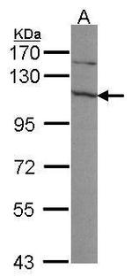 EXOSC10 Antibody in Western Blot (WB)