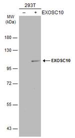 EXOSC10 Antibody in Western Blot (WB)