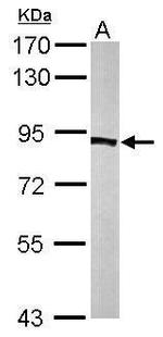 PFKP Polyclonal Antibody