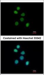 FES Polyclonal Antibody