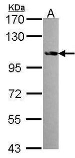 FES Antibody in Western Blot (WB)