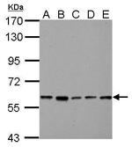 PKLR Polyclonal Antibody