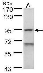 EEF2K Antibody in Western Blot (WB)