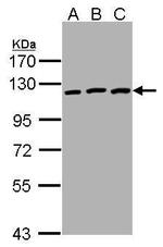 EphB3 Polyclonal Antibody