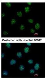 IP6K2 Antibody in Immunocytochemistry (ICC/IF)