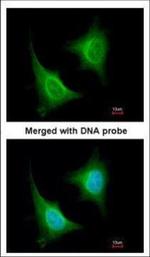 TAB1 Polyclonal Antibody
