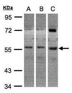 ADCK1 Polyclonal Antibody