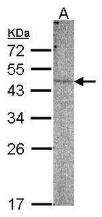 PI4K2B Polyclonal Antibody