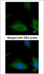 CSK Polyclonal Antibody