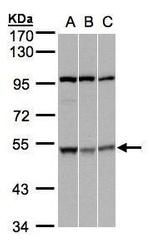 CSK Antibody in Western Blot (WB)
