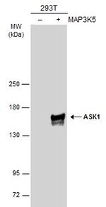ASK1 Antibody in Western Blot (WB)