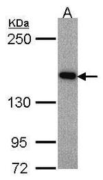 ASK1 Antibody in Western Blot (WB)