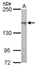 ASK1 Antibody in Western Blot (WB)