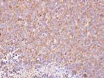 RIPK5 Polyclonal Antibody