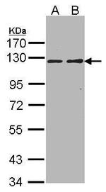 RIPK5 Antibody in Western Blot (WB)