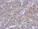 Zap-70 Antibody in Immunohistochemistry (Paraffin) (IHC (P))