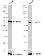 Zap-70 Antibody in Western Blot (WB)