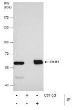 PKM2 Antibody in Immunoprecipitation (IP)