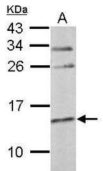 Cystatin C Polyclonal Antibody