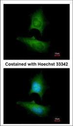 LPIN1 Polyclonal Antibody