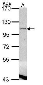 LPIN1 Antibody in Western Blot (WB)