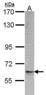 ARFGAP1/ARFGAP3 Antibody in Western Blot (WB)