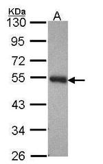 PACSIN3 Antibody in Western Blot (WB)