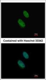 EZH1 Polyclonal Antibody