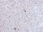 EZH1 Antibody in Immunohistochemistry (Paraffin) (IHC (P))
