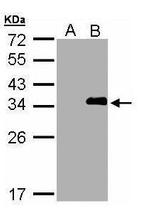 LASP1 Polyclonal Antibody