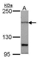 PTCH Polyclonal Antibody