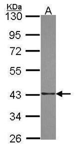SAE1 Polyclonal Antibody
