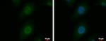 SNUPN Polyclonal Antibody