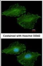 UBE2O Antibody in Immunocytochemistry (ICC/IF)