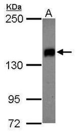 UBE2O Antibody in Western Blot (WB)