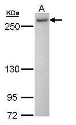 PRP8 Polyclonal Antibody