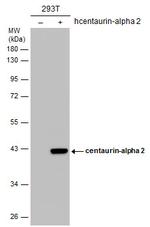 Centaurin alpha-2 Antibody in Western Blot (WB)