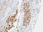 NEDL2 Antibody in Immunohistochemistry (Paraffin) (IHC (P))