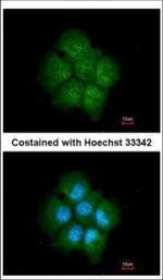 TAB182 Polyclonal Antibody